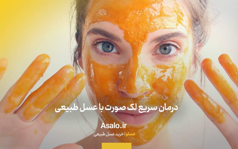درمان سریع لک صورت با عسل طبیعی